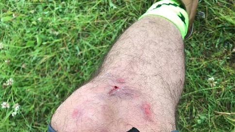 Die Devise No Pain No Gain stimmt irgendwie immer.